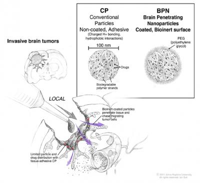 Sketch of Nanoparticle Application During Tumor Surgery