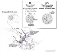 Sketch of Nanoparticle Application During Tumor Surgery
