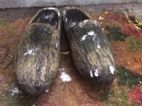 Dutch Wooden Shoes ('Klompen') May Damage Foot Bones