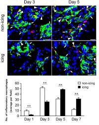 アイシングは肉離れなどの筋損傷後の再生を遅らせる Eurekalert