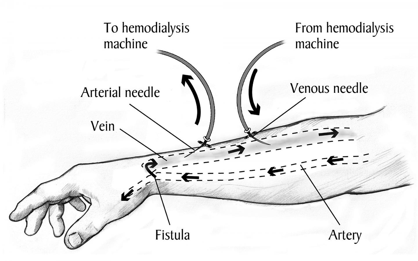 A Diagram