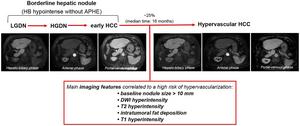 Hepatobiliary Phase Hypointense Nodules without Arterial Phase Hyperenhancement