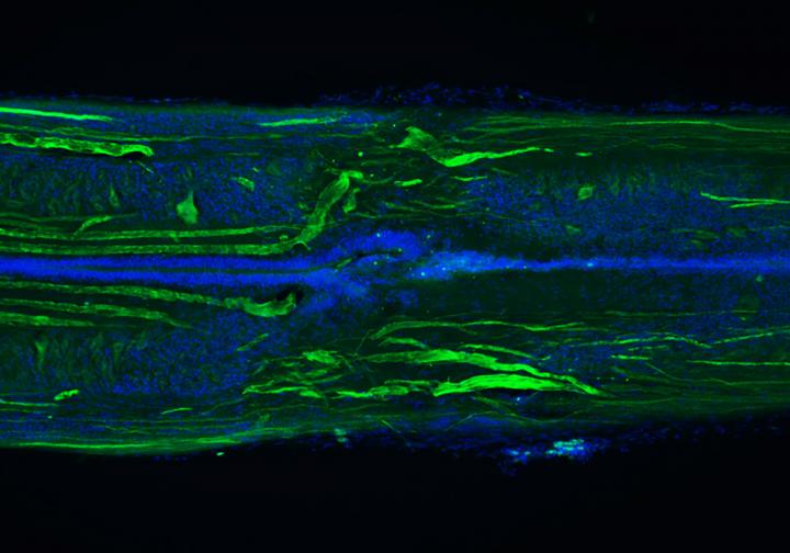 Regenerated Lamprey Spinal Cord