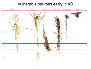 Early Neurons