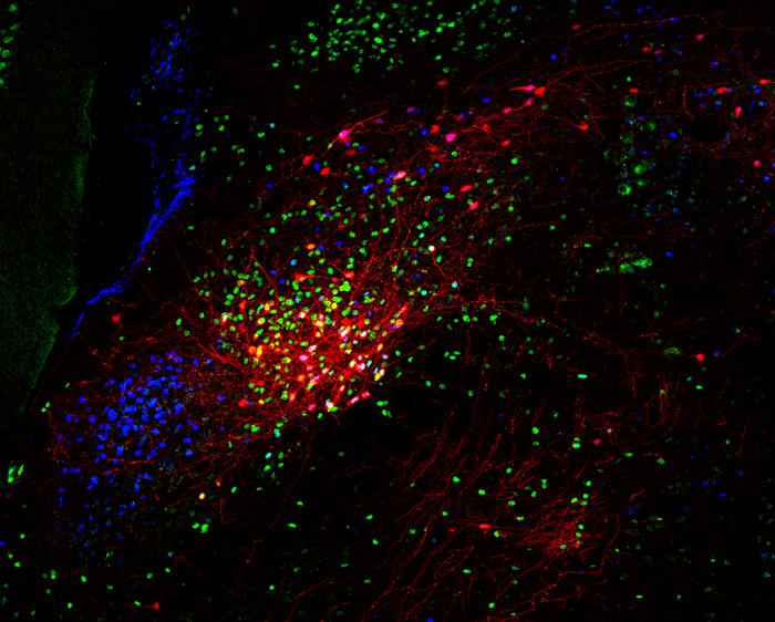 A complex patchwork of neurons in the brain's parabrachial nucleus.