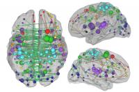 Measuring Damage to Brain Networks May Aid Stroke Treatment, Predict Recovery