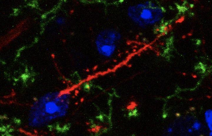 Microglia Wrapping