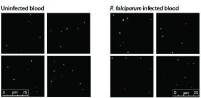 Uninfected Blood and Blood Infected with the Malaria Parasite <i>P. falciparum</i>