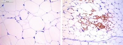 Visualization of adipocytes from an obese mouse (left) and from a lean mouse treated with digoxin (right)