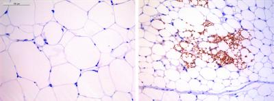 Visualization of adipocytes from an obese mouse (left) and from a lean mouse treated with digoxin (right)