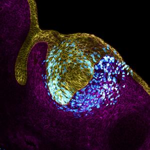 Tooth epithelium