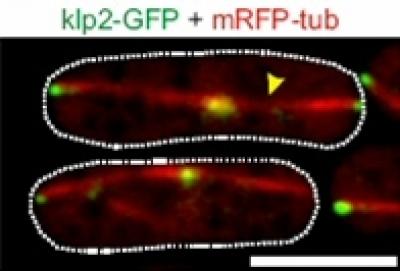 Microtubule Motors and Brakes Work Together