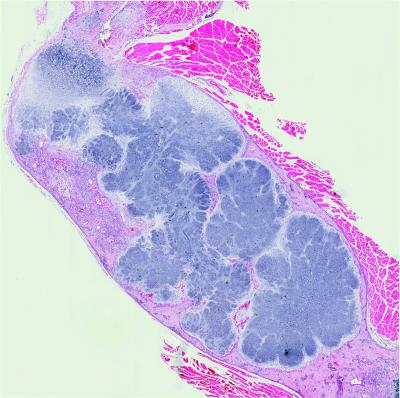 Mouse Femur with An Enchondroma-Like Structure