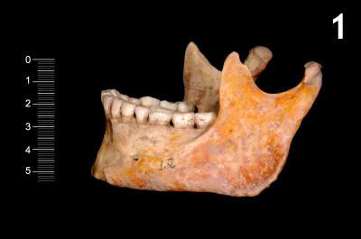 Skull and Teeth from Mesolithic Period
