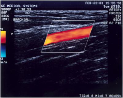 Ballerinas and Female Athletes Share Quadruple Health Threat (2 of 2)