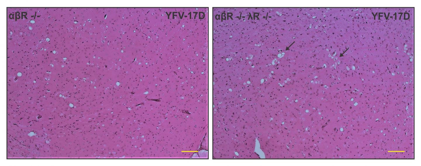 Yellow Fever Virus Image