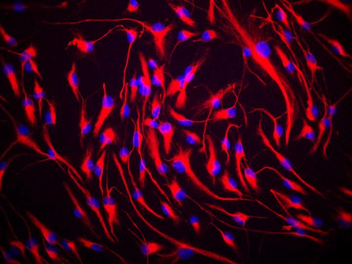Neural Stem Cells
