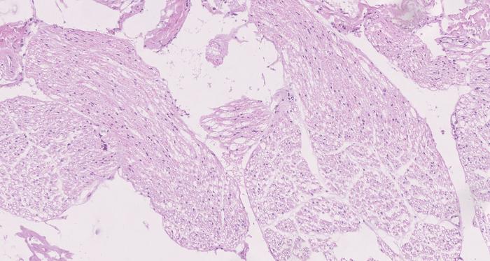 Histological sample of nerve roots