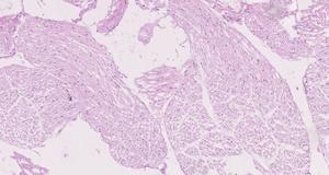 Histological sample of nerve roots