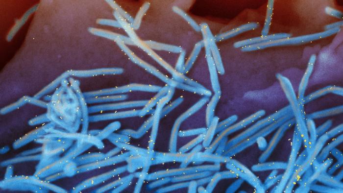 Human respiratory syncytial virus