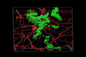 Amyloid beta plaque in neurons modeling late-onset Alzheimer's disease