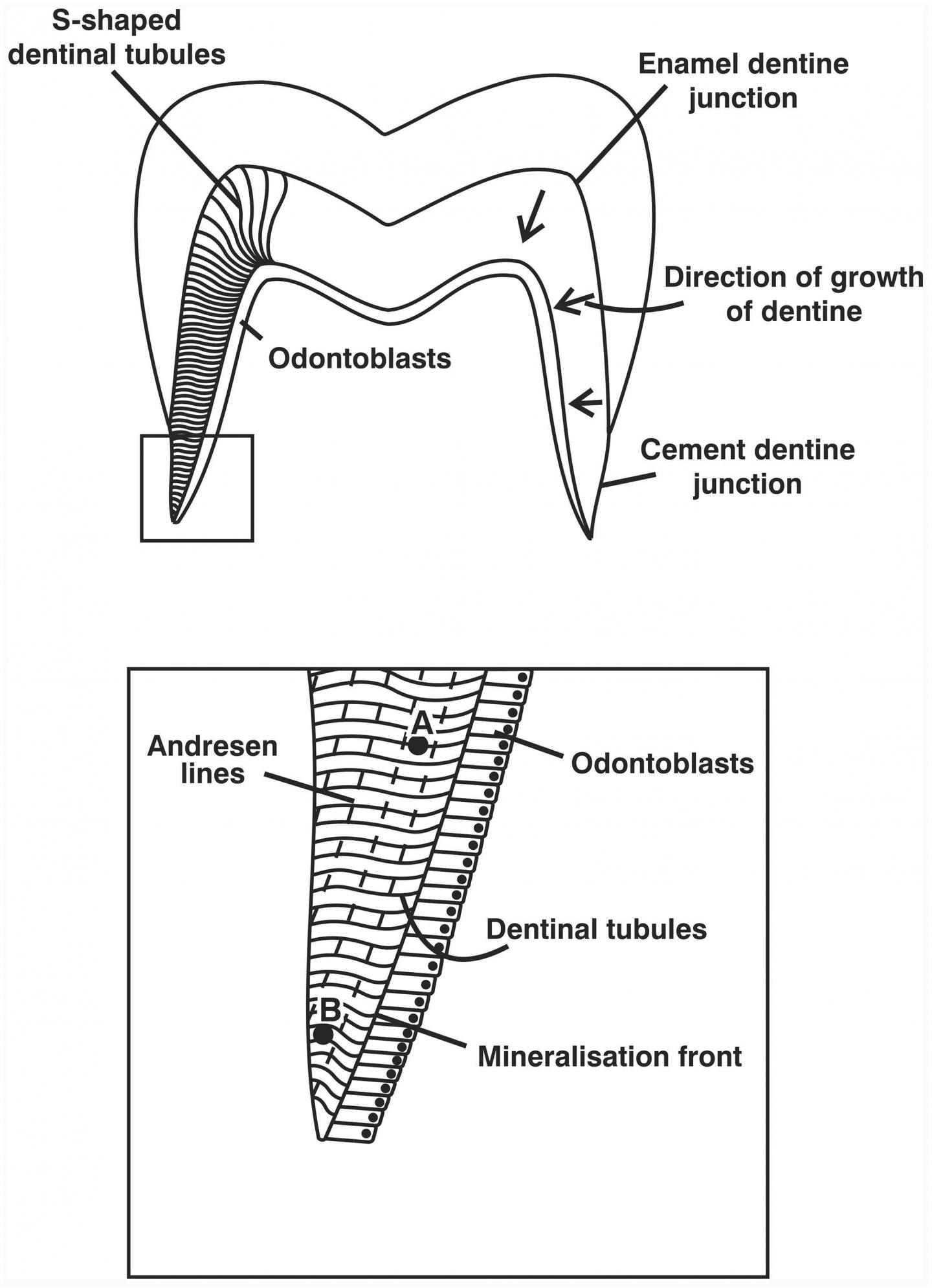Isotopic Analysis of Teeth May Identify Signs of Starvation in Victims of the Great Irish Famine