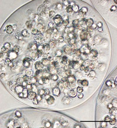 Encapsulated Mesenchymal Stem Cells