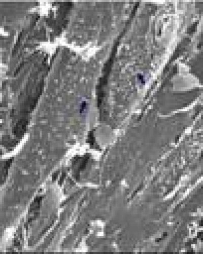 Thermosensitive Collagen Hydrogel