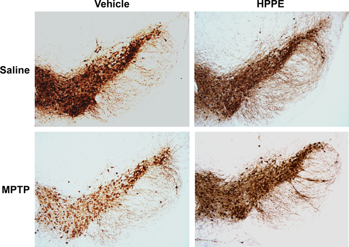Treatment using HPPE protects brain cells from neurotoxicity.