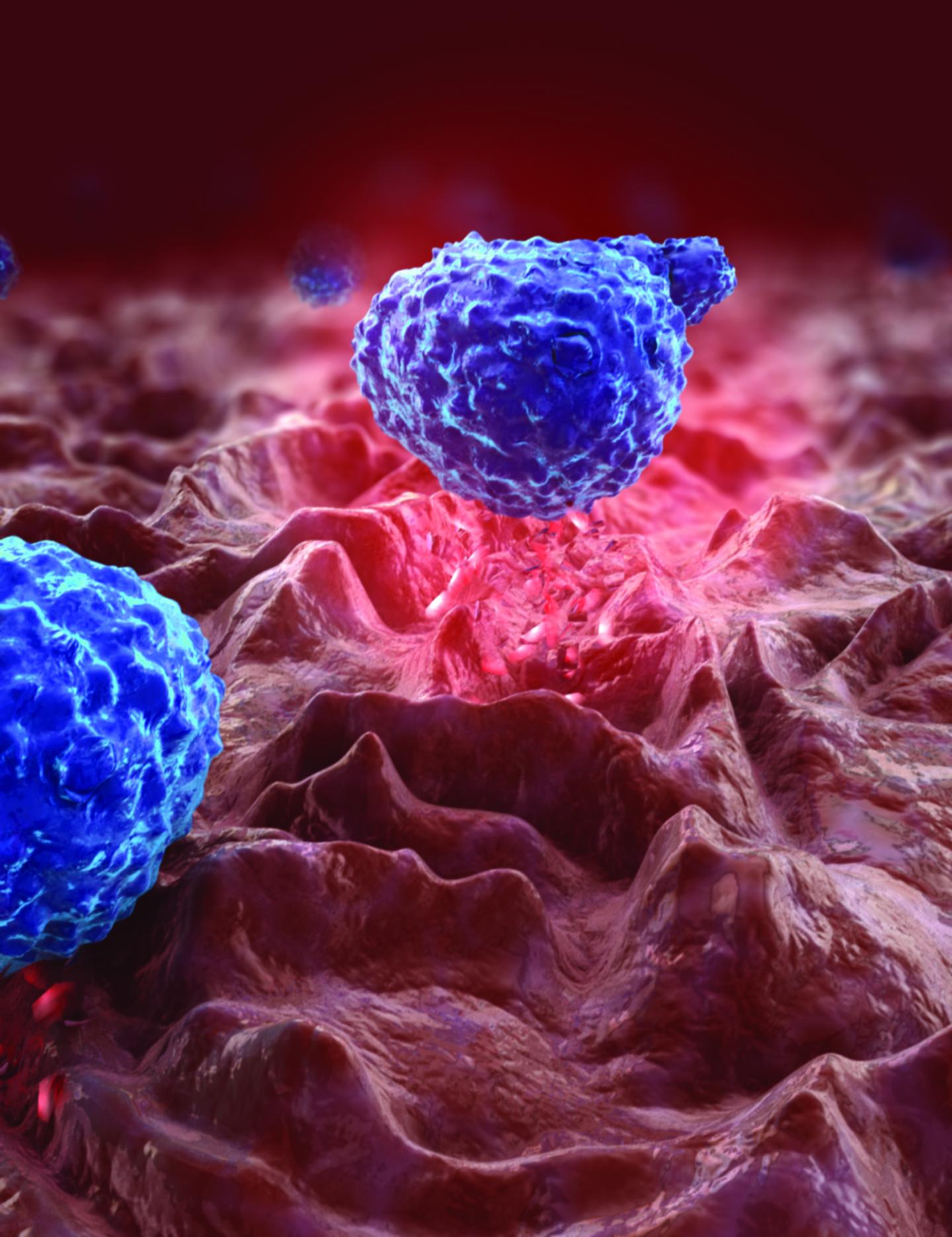 Yeast Brew Trouble for Inflammatory Bowel Disorders