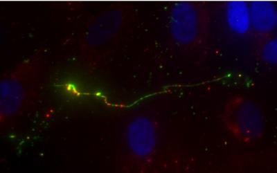 VWF Glows Brightly Green under a Microscope