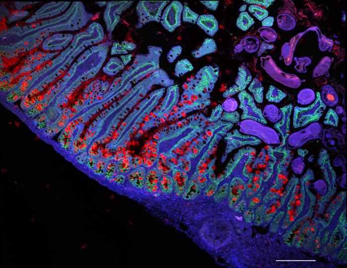 The human small intestine