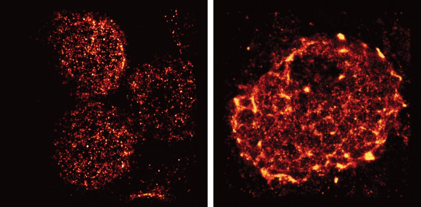 Super-Resolution Microscopy Reveals Unprecedented Detail of Immune Cells' Surface