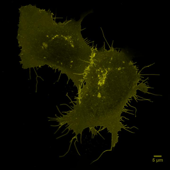 CXCR4 receptor