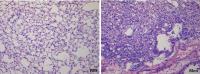 Bleomycin-induced pulmonary fibrosis in a mouse model of fibrosis