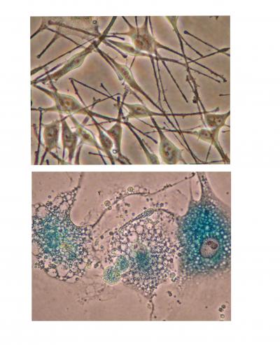 Normal and Senescent Copy