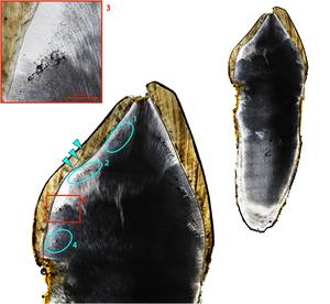 Vitamin D status in post-medieval Northern England: Insights from dental histology and enamel peptide analysis at Coach Lane, North Shields (AD 1711–1857)