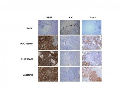 Tumorigenicity of the Pluripotent Stem Cells One Week after Treatment