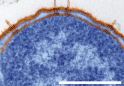 Cross Section of <I>Shigella flexneri</I>