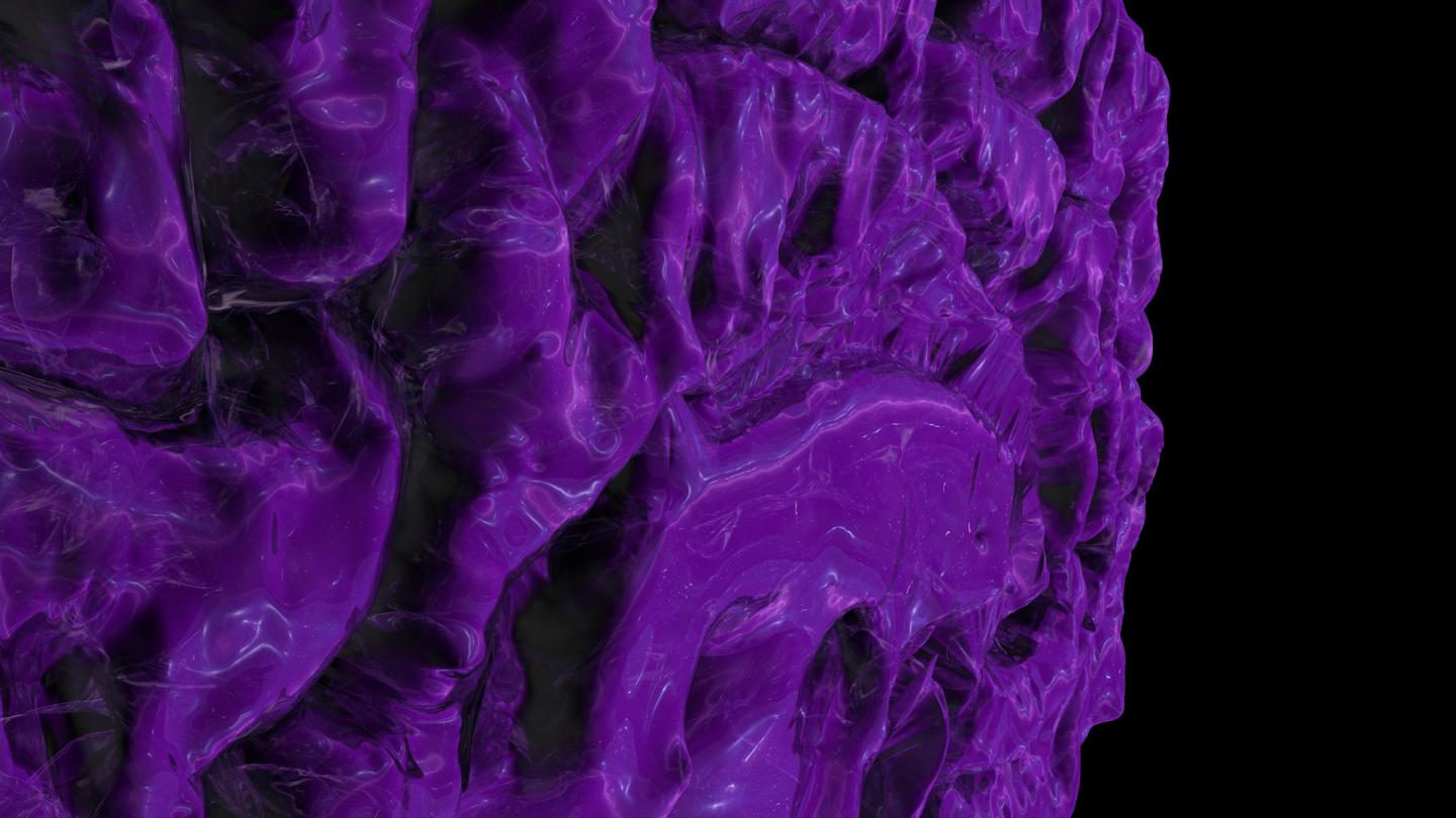 New Alzheimer's Insights