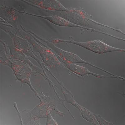 Neurons Labeled with Quantum Dots