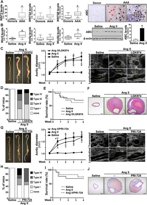 Activation of Wnt signaling in AAA and effect of LGK974 and PRI-724 on the formation of Ang II-induced AAA.