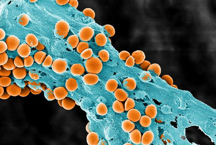 Scanning electron image of biofilm, showing bacterial cells (orange) embedded in the biofilm matrix (blue)