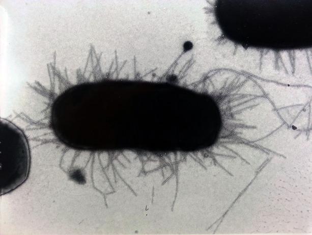 <i>E. coli</i> Bacteria