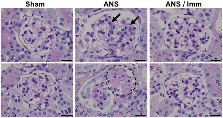 Histamine: An Unexpected Defender against Heart and Kidney Damage