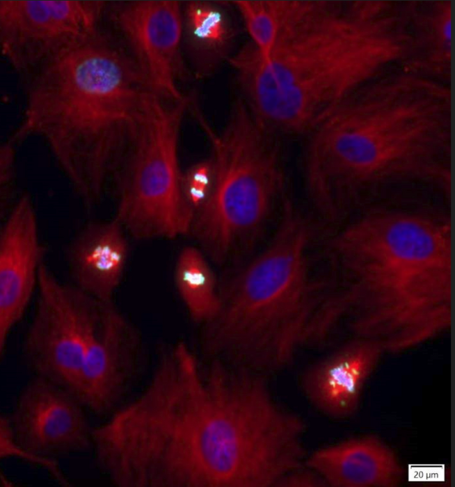 Chromosome segregation In dividing cells. Cell cytoskeleton is depicted in red, DNA is depicted in blue and a protein that marks dividing cells is depicted in green.