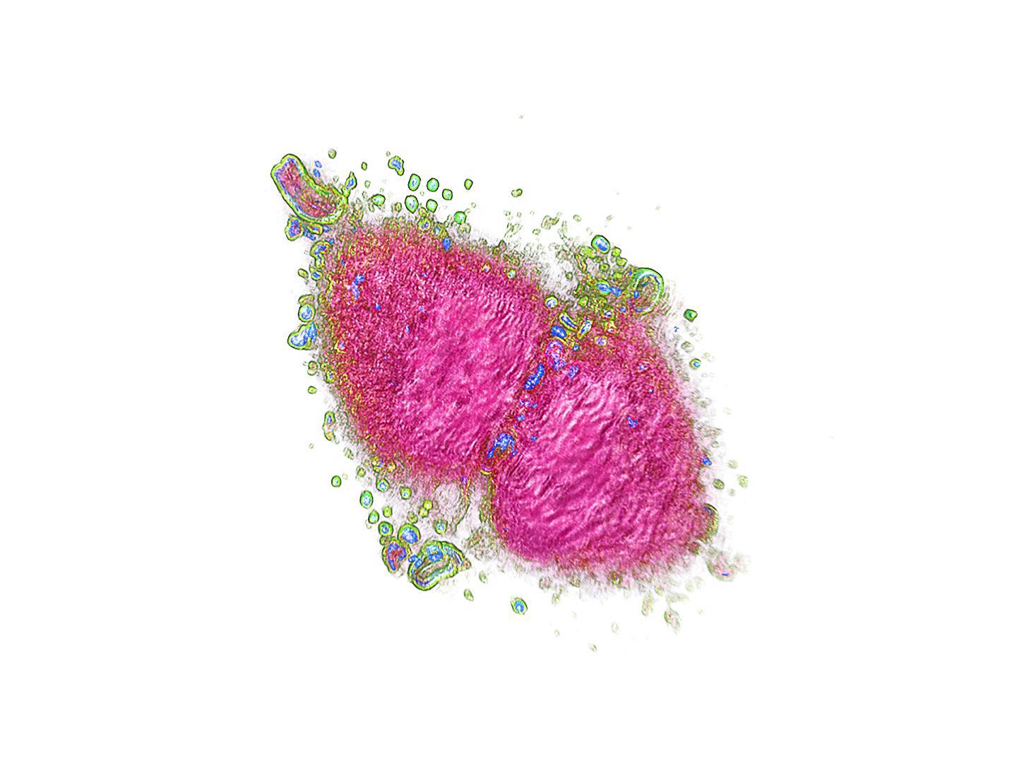 Cancer Cell with 3-D Microscope Explorer