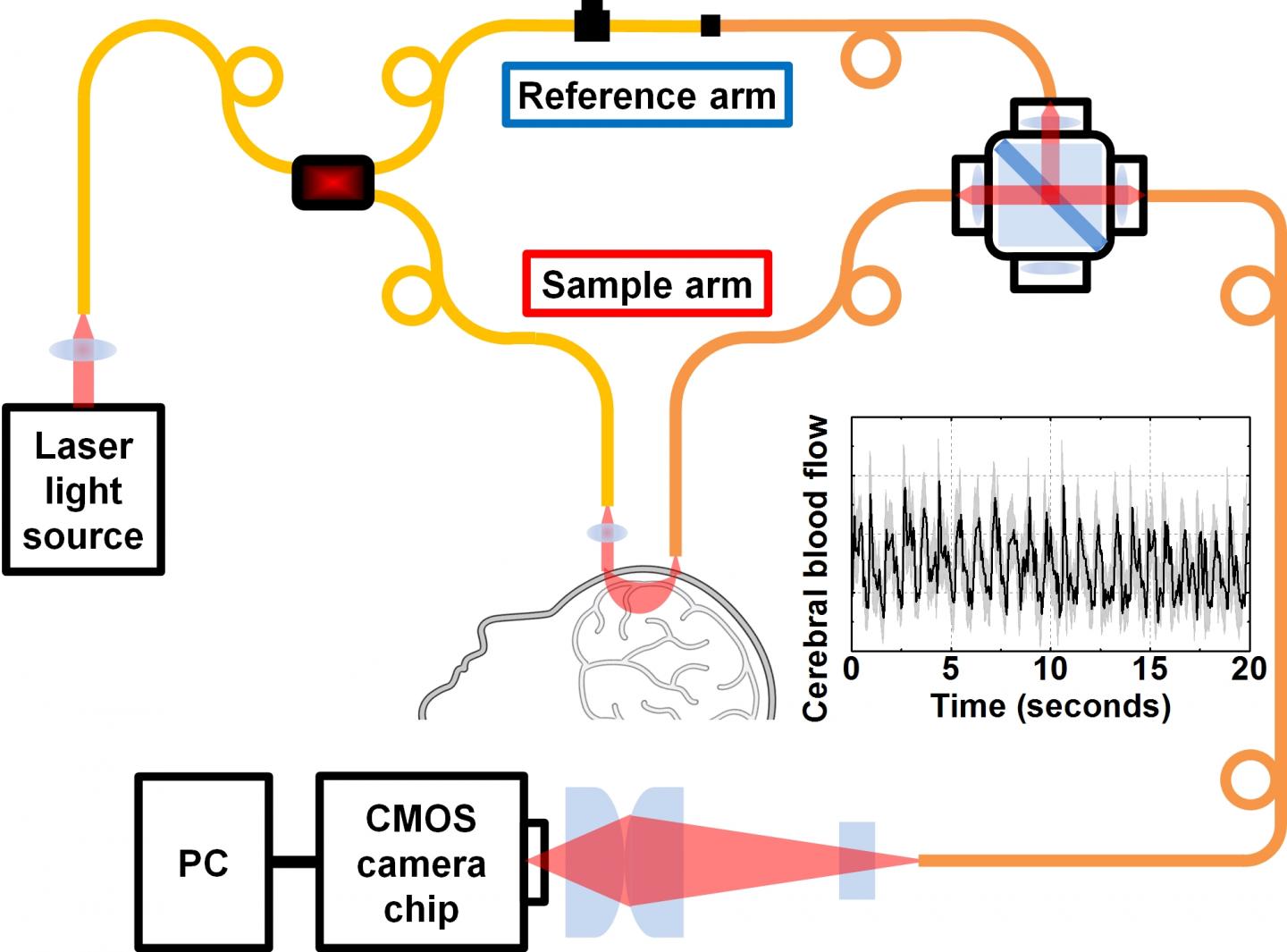 New Technology for Measuring Brain Blood Flow With Light