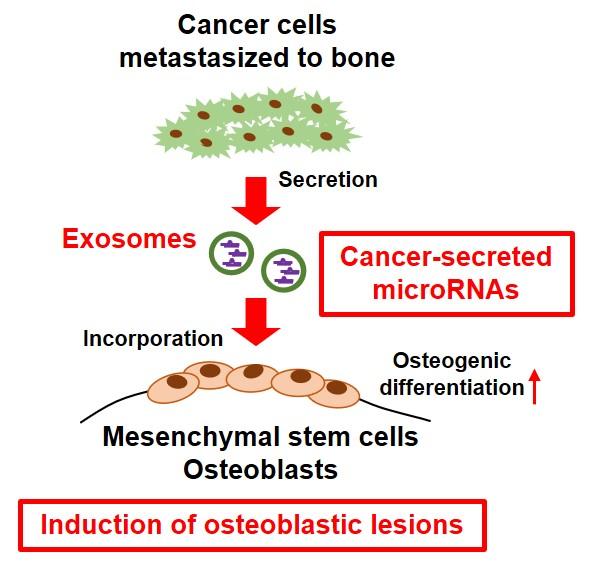 Fig.1  Osteoblastic Bone Metastasis Induced by Cancer-secreted MicroRNAs
