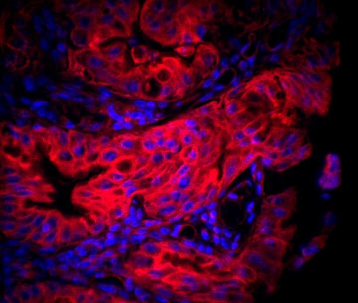 Gastric Tissue Infected by <i>H. pylori</i>